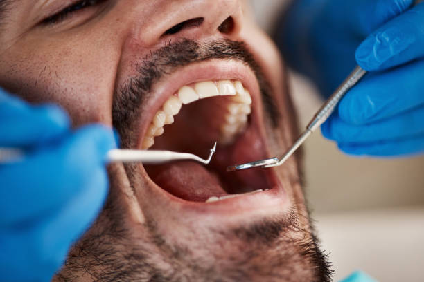 Best Tooth Infection Emergency Dentist  in Kure Beach, NC